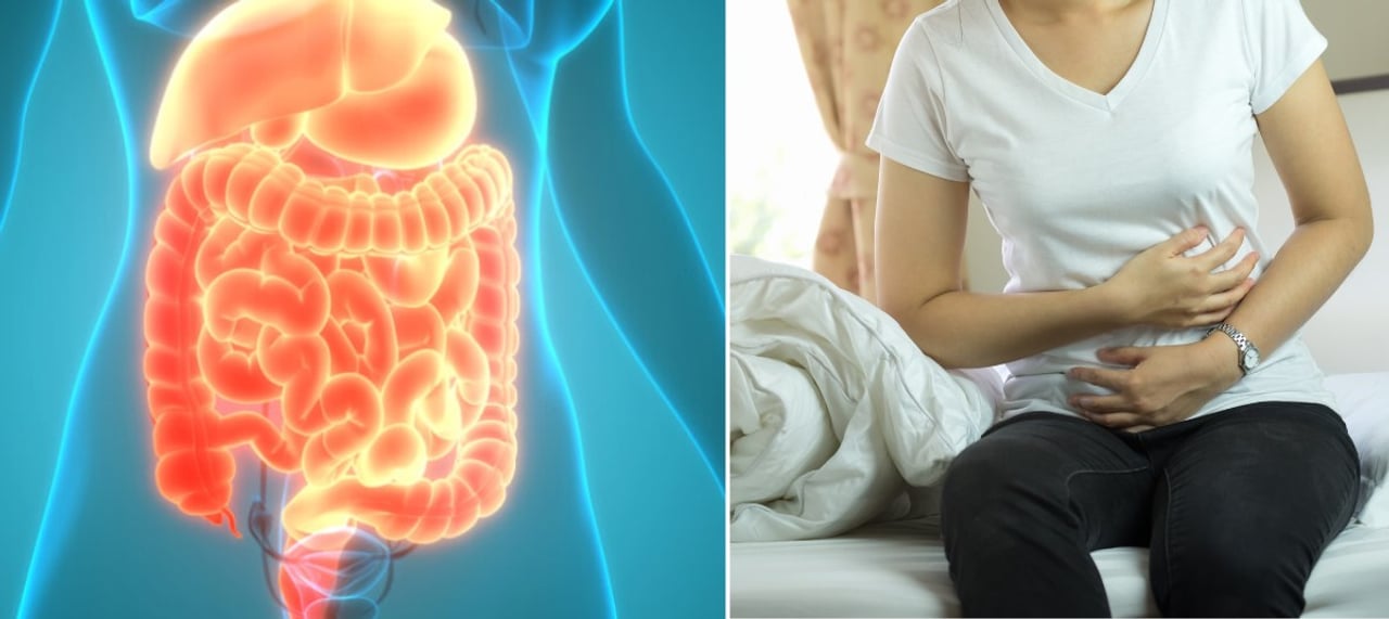 Cáncer de colon: señales de alerta, riesgos y formas de prevenirlo