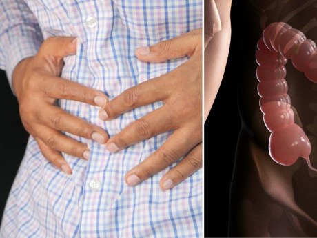 Cáncer de colon: señales de alerta, riesgos y formas de prevenirlo